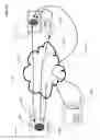 Fig. 06 - Image transforming vision enhancement device