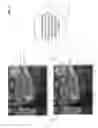 Fig. 20 - Image transforming vision enhancement device