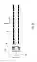 Fig. 16 - Mass analyser and method of mass analysis