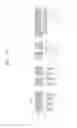 Fig. 100 - Semiconductor devices including bit line contact plug and peripheral transistor