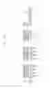 Fig. 159 - Semiconductor devices including bit line contact plug and peripheral transistor