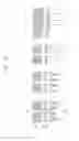 Fig. 16 - Semiconductor devices including bit line contact plug and peripheral transistor