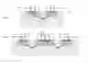 Fig. 05 - Electrostatic discharge protection device
