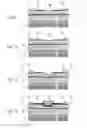 Fig. 05 - Method for forming an implanted area for a heterojunction transistor that is normally blocked