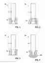 Fig. 02 - Terminal pin, feedthrough of an implantable electromedical device and process for making the same