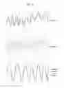 Fig. 06 - Method and apparatus for reconstructing desired signal in case of using full duplex radio (FDR) scheme