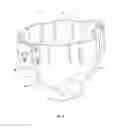 Fig. 11 - Shock-resistant camera mounting device and methods of forming the same