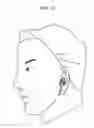 Fig. 13 - Earphone device