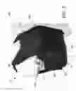 Fig. 04 - CONCEALABLE BODY ARMOR SYSTEM