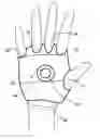 Fig. 01 - Glove gun
