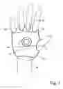 Fig. 02 - Glove gun