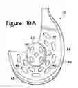 Fig. 15 - Article of footwear incorporating a sole structure with elements having different compressibilities