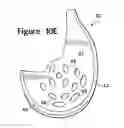 Fig. 19 - Article of footwear incorporating a sole structure with elements having different compressibilities