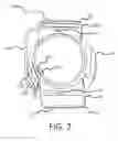 Fig. 03 - SMARTPHONE ARMLET