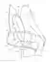 Fig. 01 - Device and method for assisting patients after a buttocks surgery