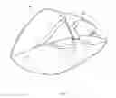 Fig. 06 - Device and method for assisting patients after a buttocks surgery