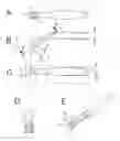 Fig. 01 - Eating utensil