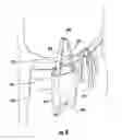 Fig. 07 - SAFETY POCKET FOR COMMERCIAL KITCHEN UTENSILS AND METHODS OF USING THE SAME