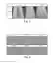 Fig. 04 - SCOURING PAD FOR WASHING DISHES