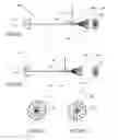 Fig. 11 - Imaging system producing multiple registered images of a body lumen