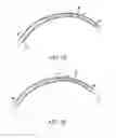 Fig. 03 - AIRWAY TUBE AND VISUALISATION DEVICE ASSEMBLY