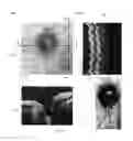 Fig. 04 - Method of motion correction in optical coherence tomography imaging