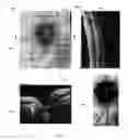 Fig. 05 - Method of motion correction in optical coherence tomography imaging