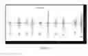 Fig. 04 - Non-invasive diagnostic device based on audiometric analysis