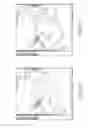 Fig. 11 - Methods and systems for generating integrated substrate maps for cardiac arrhythmias