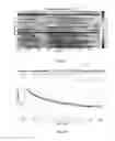 Fig. 05 - System, apparatus and methods for data collection and assessing outcomes