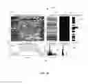Fig. 27 - System, apparatus and methods for data collection and assessing outcomes