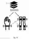 Fig. 15 - METHODS AND SYSTEMS FOR DETECTING MOVEMENT DISORDER