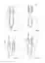 Fig. 06 - Device for cross flow filtration