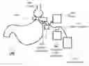 Fig. 01 - Apparatus and methods for corrective guidance of eating behavior after weight loss surgery