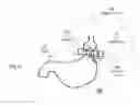 Fig. 10 - Apparatus and methods for corrective guidance of eating behavior after weight loss surgery