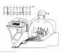 Fig. 01 - SYSTEM AND METHOD FOR DETECTING AN ARRHYTHMIC CARDIAC EVENT FROM A CARDIAC SIGNAL