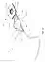 Fig. 12 - SYSTEMS AND METHODS FOR SECURING A PERIPHERAL ULTRASOUND DEVICE