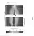 Fig. 08 - ULTRASONIC ARRAY FOR BONE SONOGRAPHY