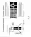 Fig. 19 - ULTRASONIC ARRAY FOR BONE SONOGRAPHY