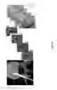 Fig. 24 - ULTRASONIC ARRAY FOR BONE SONOGRAPHY