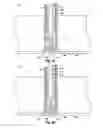 Fig. 21 - SUTURE SECURING SYSTEMS, DEVICES AND METHODS