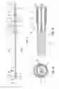 Fig. 02 - Bioresorbable detachable tip design for adhesive-based extravascular closure device