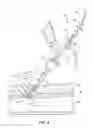 Fig. 07 - Bioresorbable detachable tip design for adhesive-based extravascular closure device
