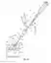 Fig. 11 - Bioresorbable detachable tip design for adhesive-based extravascular closure device