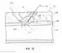 Fig. 12 - Bioresorbable detachable tip design for adhesive-based extravascular closure device