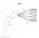 Fig. 02 - Transitional geometry for an expandable medical device