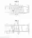 Fig. 03 - Transitional geometry for an expandable medical device
