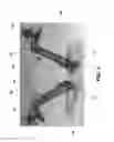 Fig. 04 - Orthopedic tools for implantation