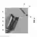 Fig. 05 - Orthopedic tools for implantation