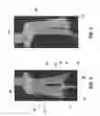 Fig. 06 - Orthopedic tools for implantation
